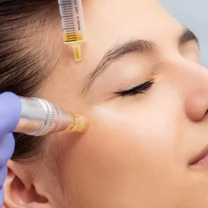 Mesoterapia Facial